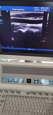 PH L12-5 Ιατρική διάγνωση Υπερήχων γραμμικού μετρητή μετασχηματιστή για PH HD9 συμβατό